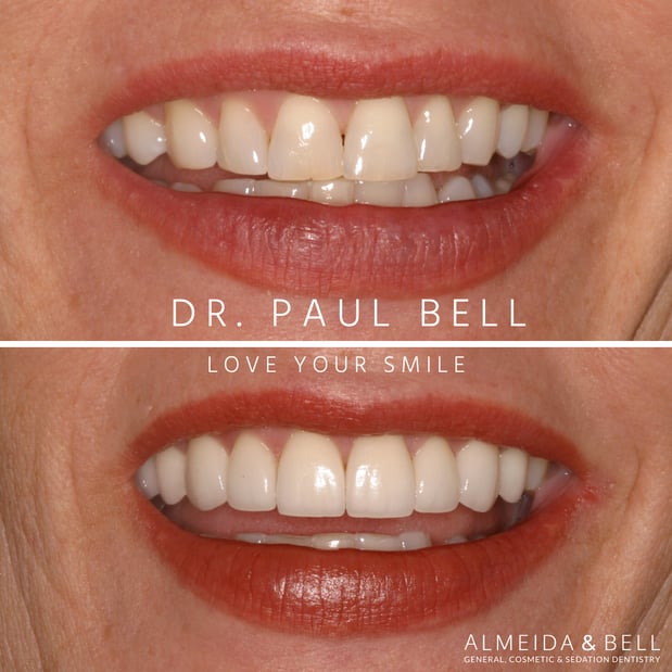 Images Almeida & Bell Dental Lone Tree - General, Cosmetic, and Implant Dentistry