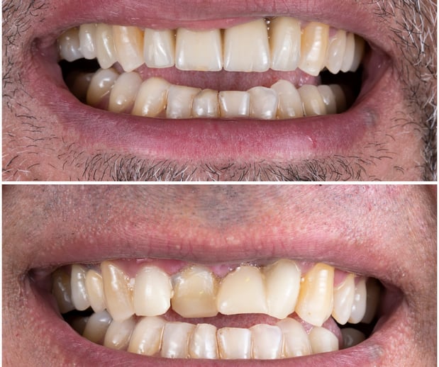 Images Silver State Dental