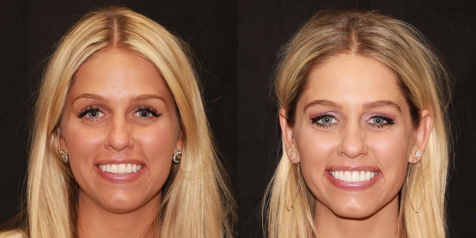 Intermountain Smiles Image