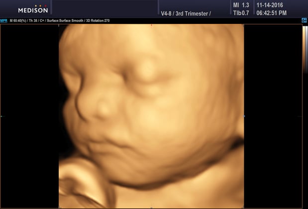 Images Heavenly 3D 4D Ultrasounds