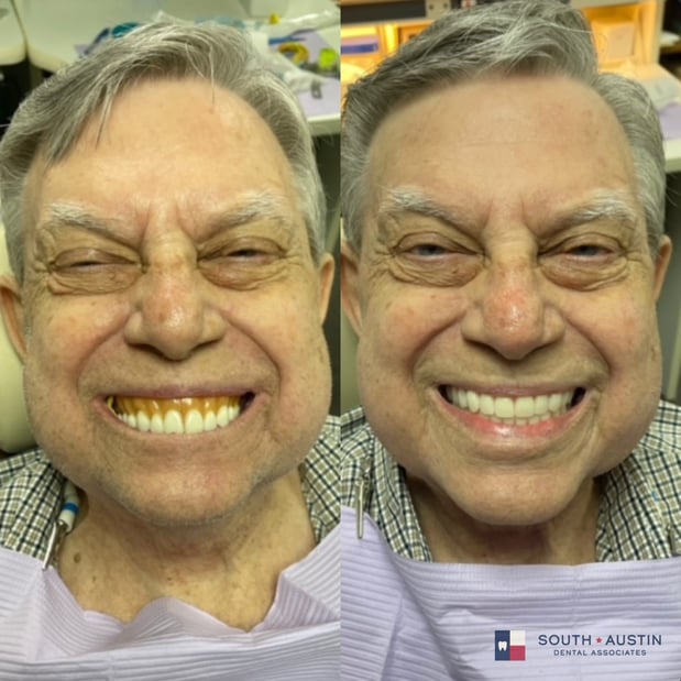 Images South Austin Dental Associates
