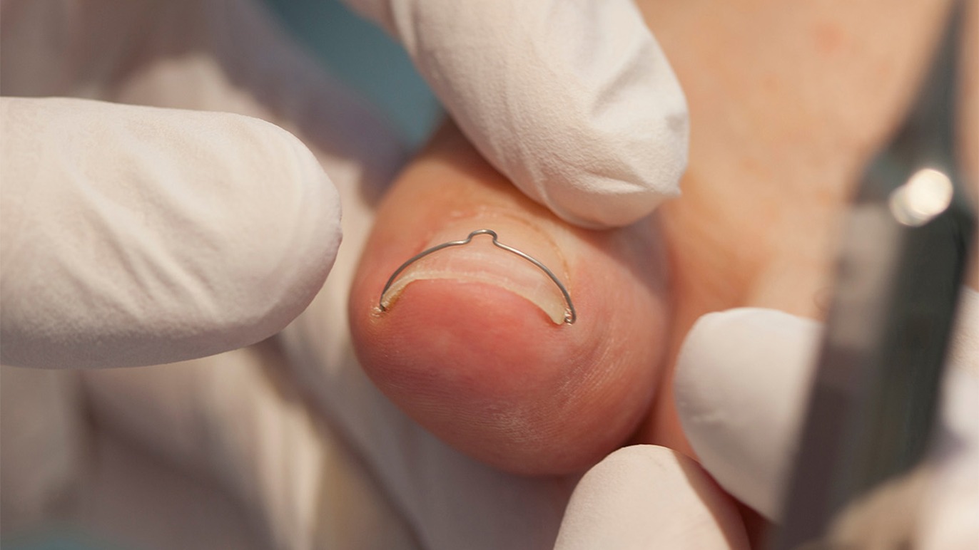 Images Klinik for fodterapi Mia Johansen