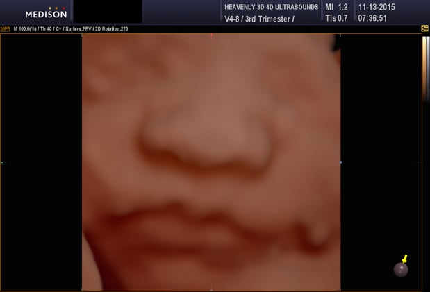 Images Heavenly 3D 4D Ultrasounds-Upland