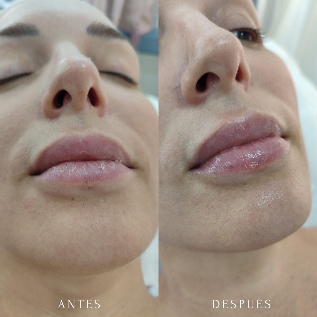 Images Wendecy Ortega Belleza Integral y Estética Avanzada