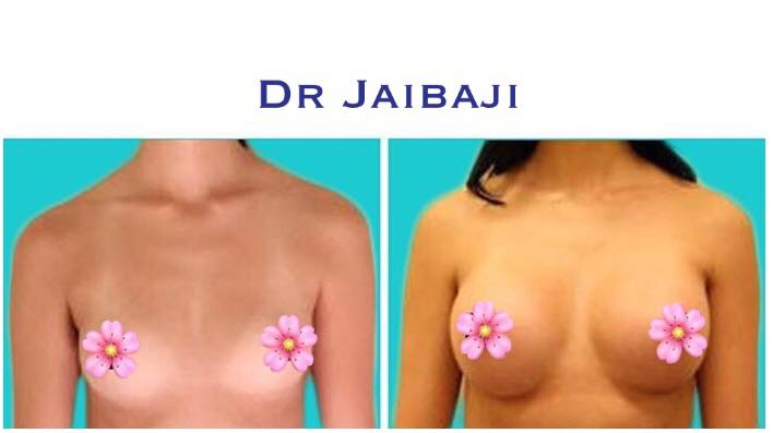 Jaibaji Plastic Surgery Photo