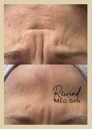 Images Rewind Med Spa