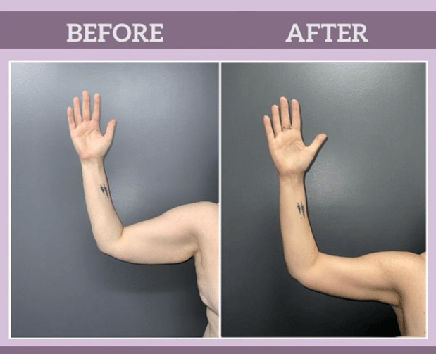 Images Semira Bayati, MD, FACS