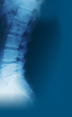 Images James H Rhee, MD