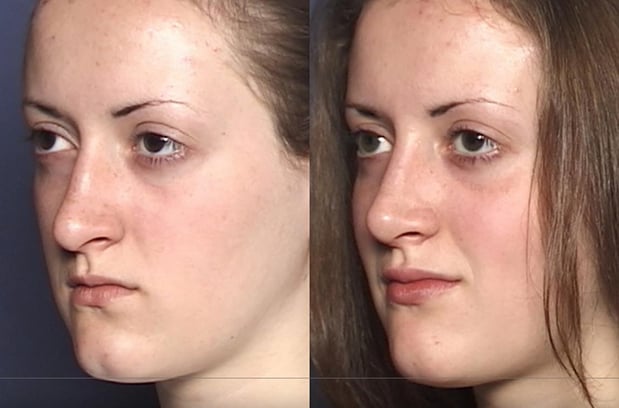 Images Rejuvenis Facial Cosmetic Surgery and Medical Spa