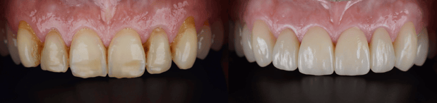 Images Jeppson Dental