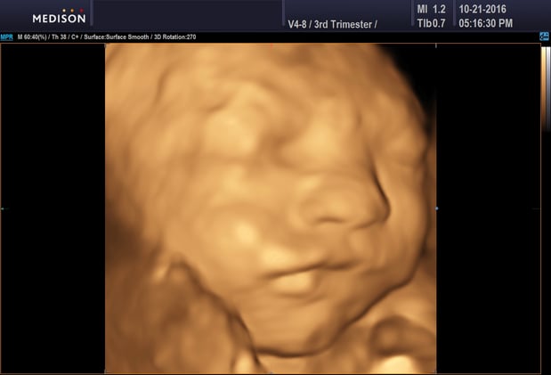 Images Heavenly 3D 4D Ultrasounds