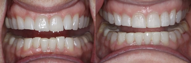 Images Cedar Hills Family Dentistry