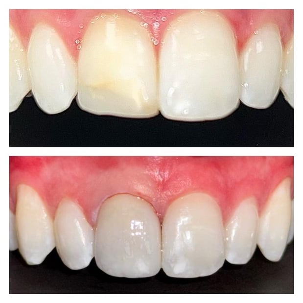 Images Aspire Dental Wellness - SouthPark Charlotte