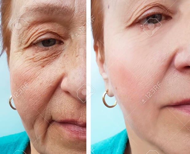 Images Renew Body Contouring & MedSpa