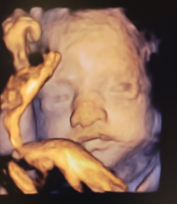 Images Love At First Sight 3D/4D Ultrasound Imaging Studio, LLC