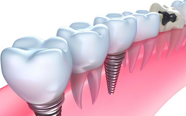 Images Dentamia. Clínica Dental
