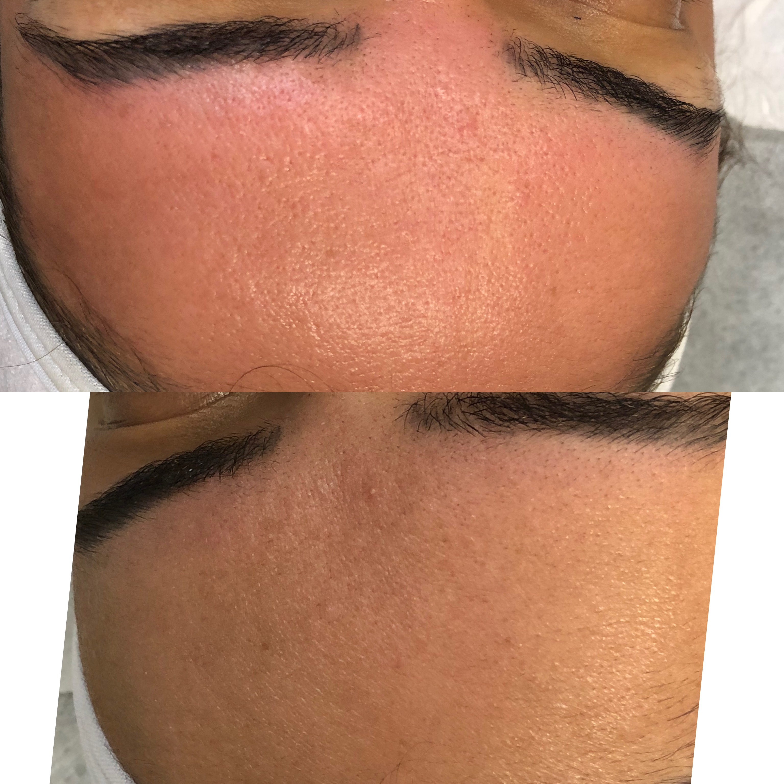 Images Clinique d'Esthétique Leila - Hydrafacial, Microblading, Épilation Laser Sainte-Foy