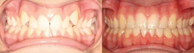 Images Speaker Orthodontics