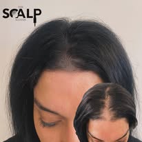 Images The Scalp Master