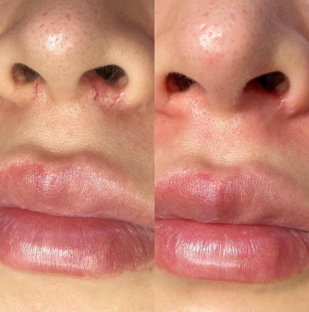 Images Face of Jules