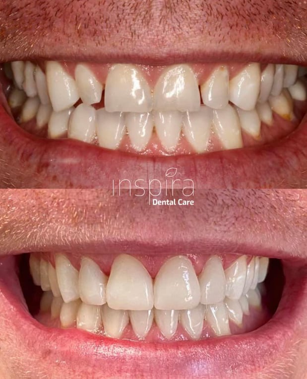 Images Inspira Dental Care