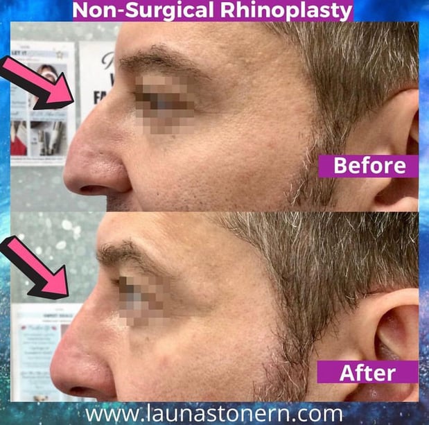 Images Launa Stone, R.N.