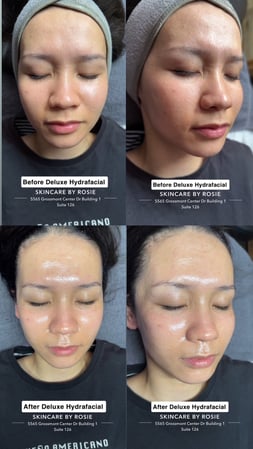 Images Skincare by Rosie