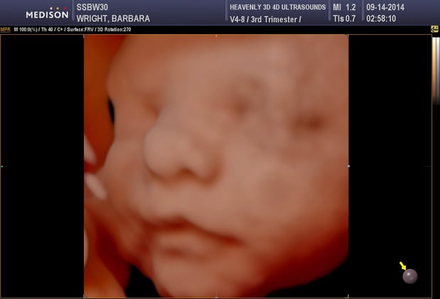 Images Heavenly 3D 4D Ultrasounds-Upland