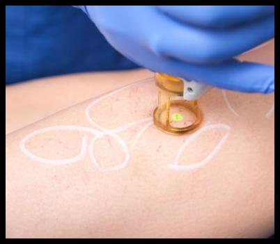 Images Mondin Dr. Giorgio Specialista in Dermatologia