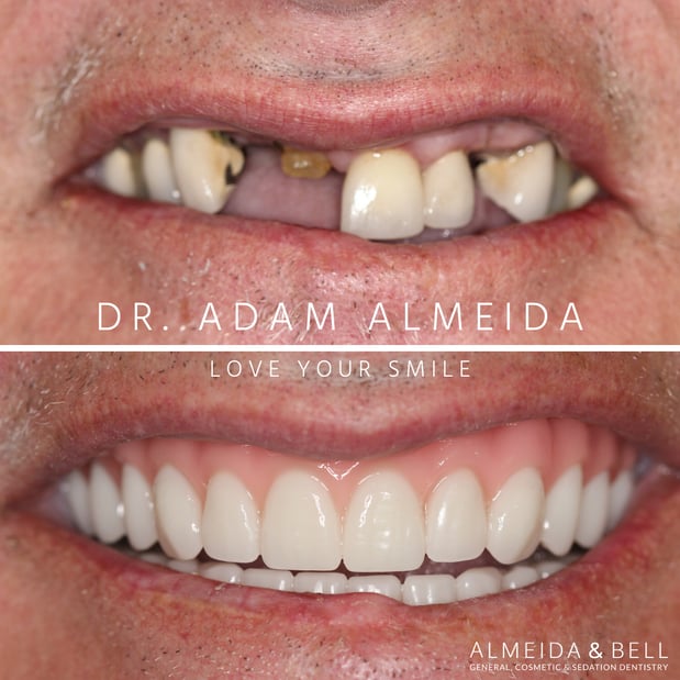 Images Almeida & Bell Dental Lone Tree - General, Cosmetic, and Implant Dentistry