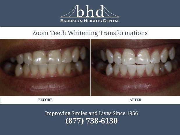 Images Brooklyn Heights Dental