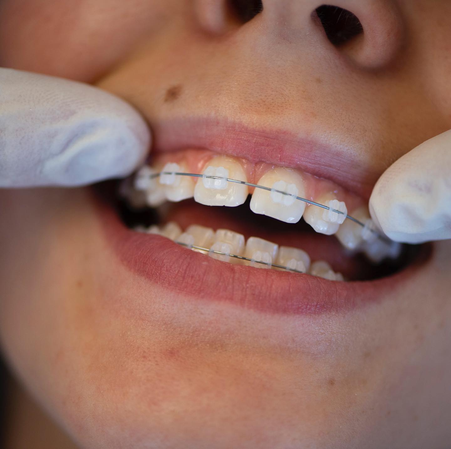 Images Orthodontix Northbridge