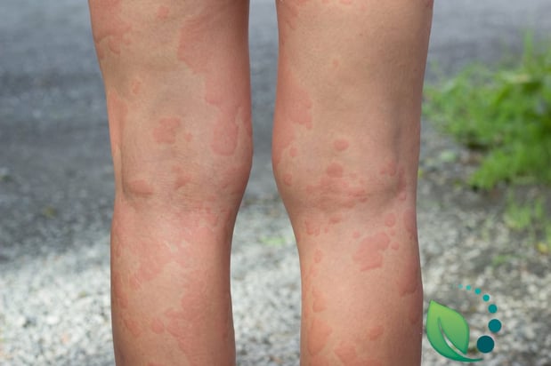 Images Gupta Allergy: Allergy & Asthma Specialists of Lansing, PLLC