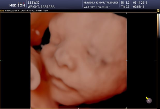 Images Heavenly 3D 4D Ultrasounds-Upland