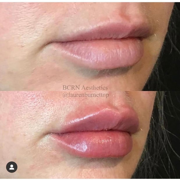 Images BCRN Aesthetics MedSpa