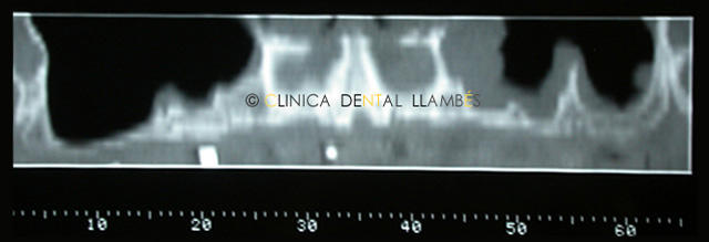 Images Clínica Dental Llambés