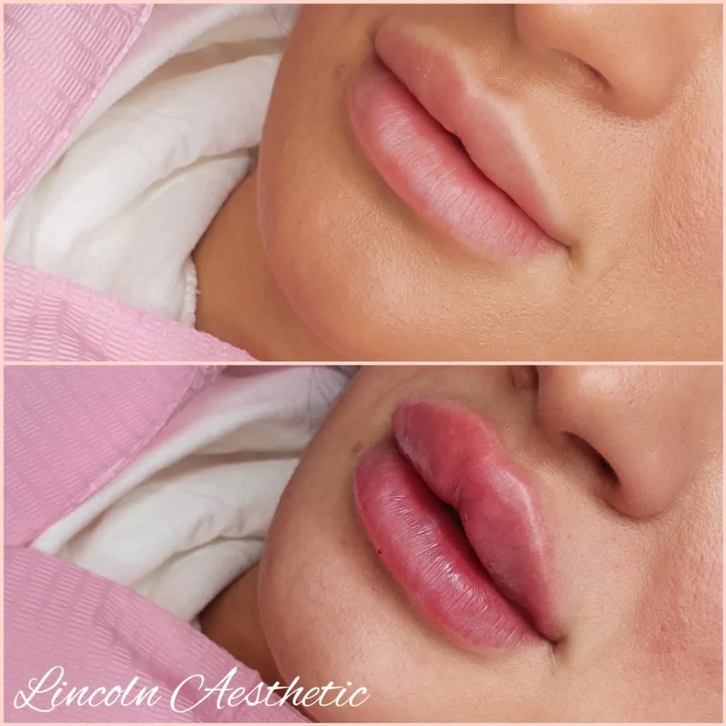 Images Lincoln Aesthetic