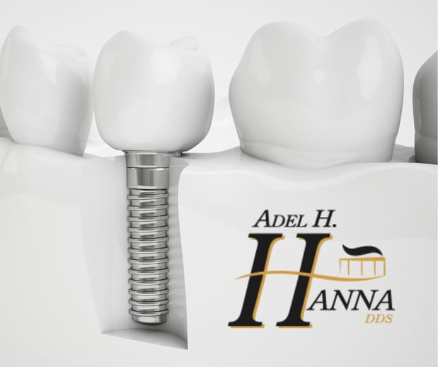Images Adel H Hanna, DDS & Assoc.