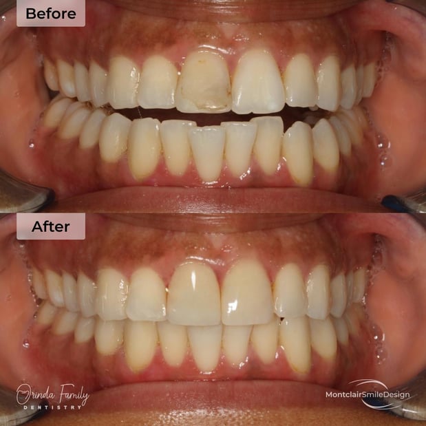 Images Orinda Family Dentistry