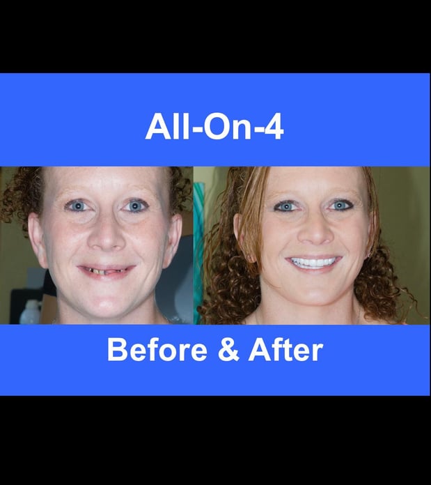 Images Decatur Smiles