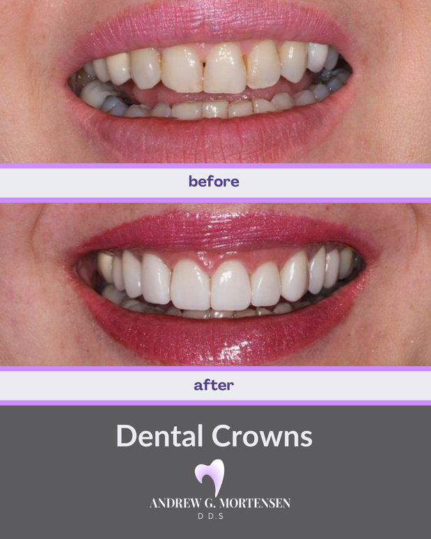Images Andrew G. Mortensen, DDS