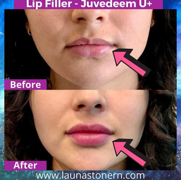 Images Launa Stone, R.N.