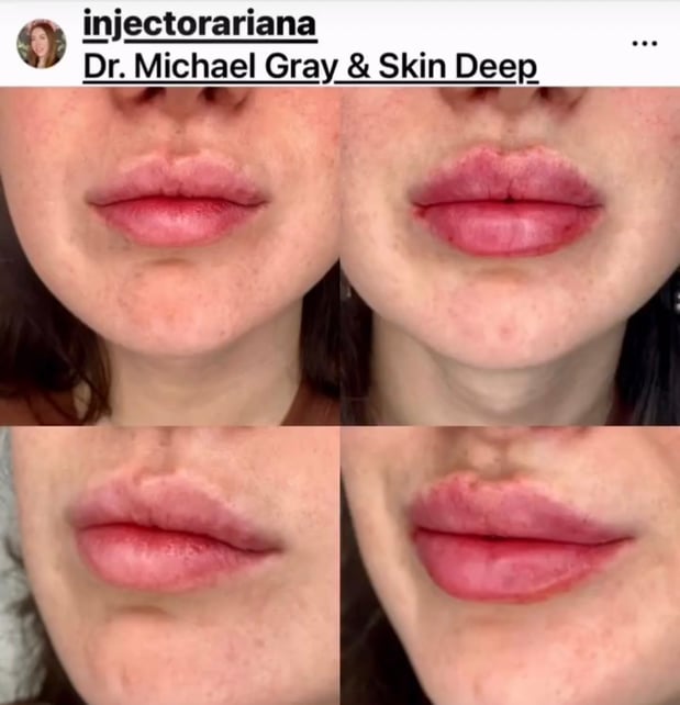 Images Dr. Michael Gray: The Michigan Cosmetic Surgery Center and Skin Deep Spa