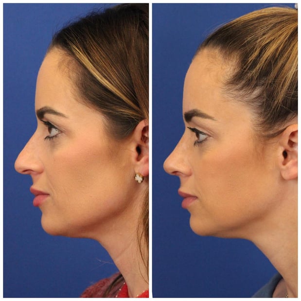 Images Dr. Sumit Bapna, MD