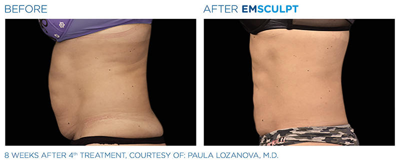 Slim Studio EMSCULPT & Coolsculpting Photo