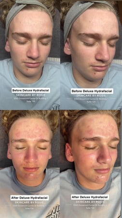 Images Skincare by Rosie