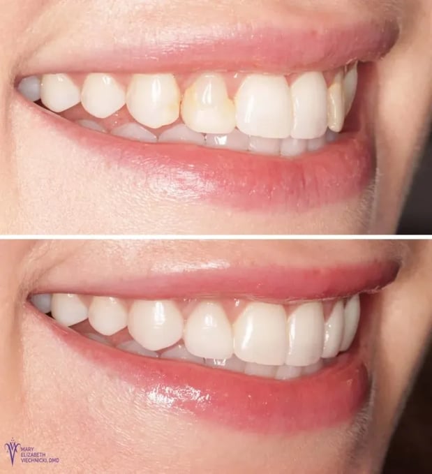 Images Mary Elizabeth Viechnicki, DMD