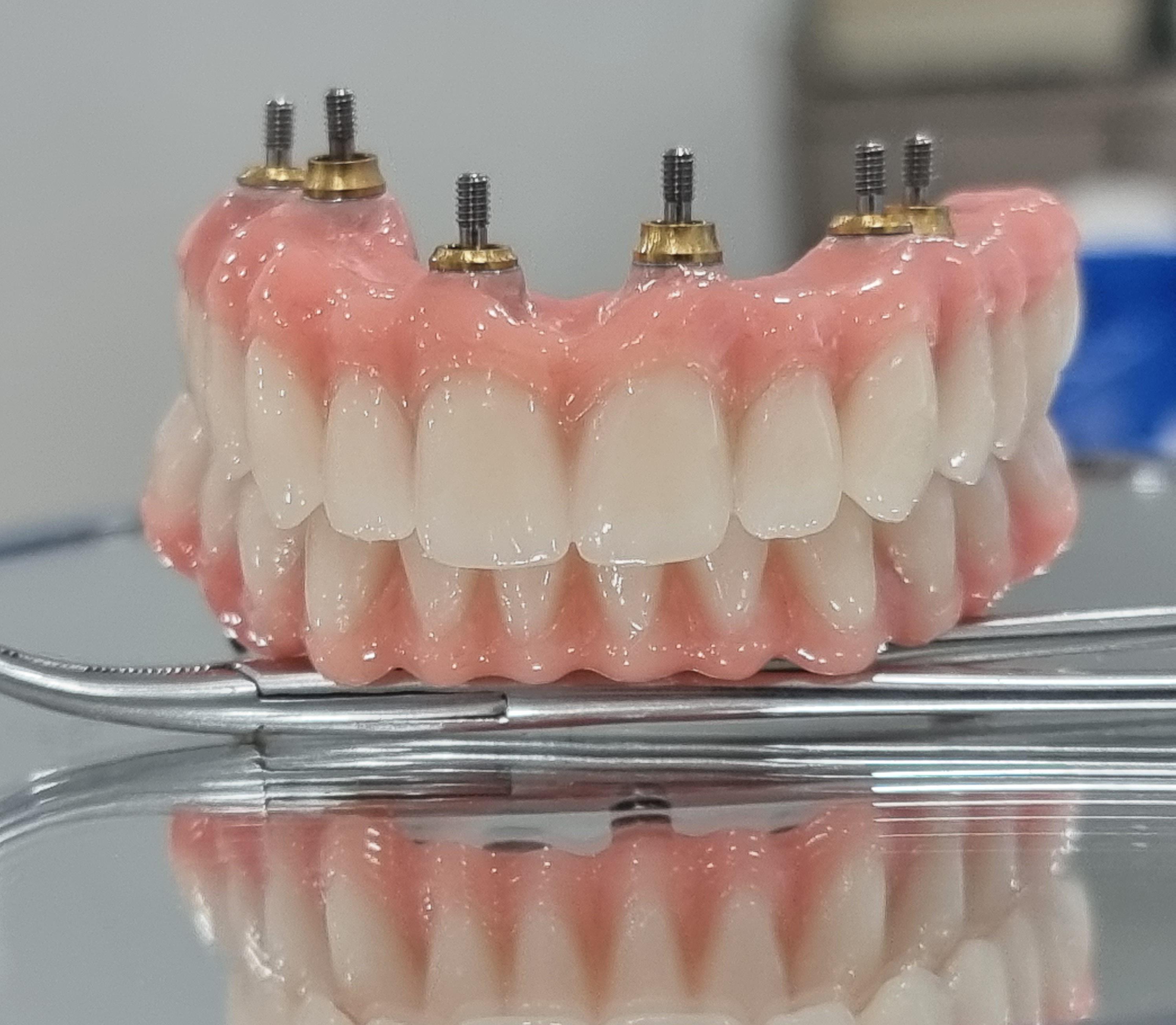 Images Técnicas Dentales Avanzadas De Cantabria