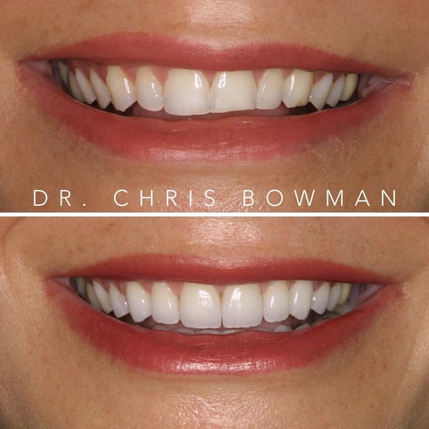 Images Advanced Dentistry of Charlotte