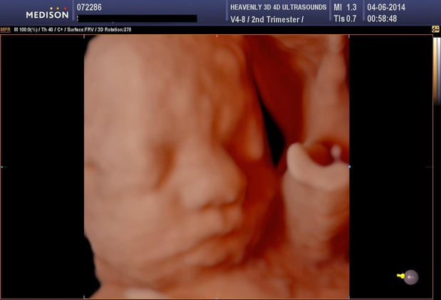 Images Heavenly 3D 4D Ultrasounds-Upland